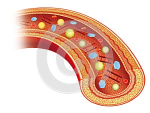 Hiperglucemia