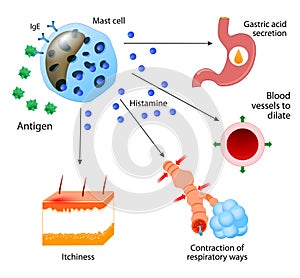 Histamine. Allergies or allergic diseases