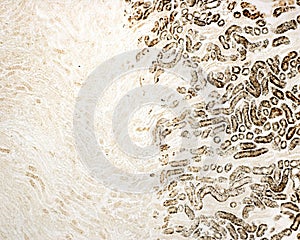 Kidney. Acid phosphatase photo