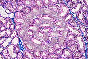 Histological Epididymis and Testis human cells under microscope.