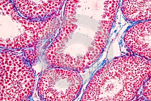 Histological Epididymis and Testis human cells under microscope.