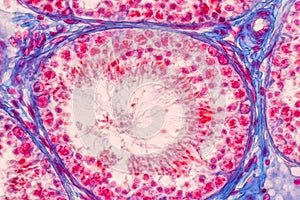 Histological Epididymis and Testis human cells under microscope.