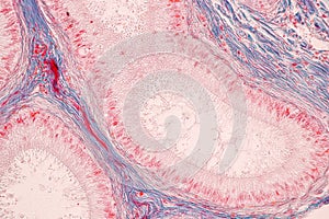 Histological Epididymis and Testis human cells under microscope.