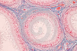 Histological Epididymis and Testis human cells under microscope.