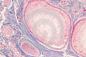 Histological Epididymis and Testis human cells under microscope.