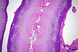 Microscopic Analysis of Tissue Section Revealing Lumen and Connective Tissue Structures for Diagnostic Purposes photo