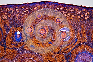 Histological image of an ovary showing primary, secondary and terciary follicles 100x magnification photo