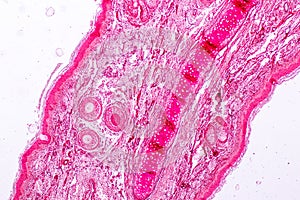 Histological sample Elastic cartilage Tisue under the microscope. photo