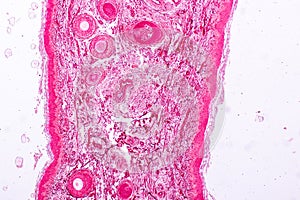 Histological sample Elastic cartilage Tisue under the microscope. photo
