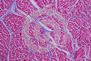 Histological sample Heart muscle Tissue under the microscope. photo