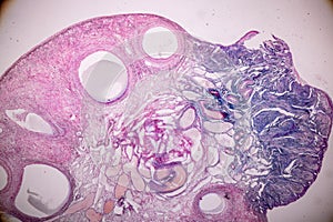 Histological sample Ovary of rabbit Tissue under the microscope.