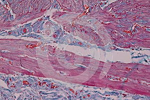 Histological sample Simple columnar epithelium Tissue under the microscope.