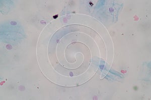Histological sample Squamous epithelial cells under microscope.