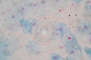 Histological sample Squamous epithelial cells under microscope.