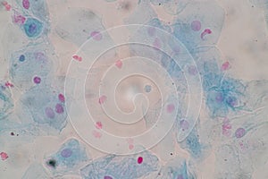 Histological sample Squamous epithelial cells under microscope.