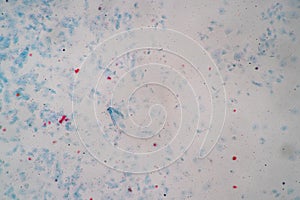 Histological sample Squamous epithelial cells under microscope.