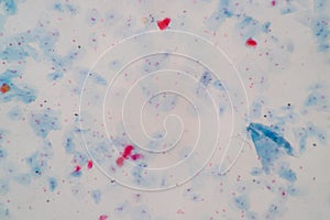 Histological sample Squamous epithelial cells under microscope.