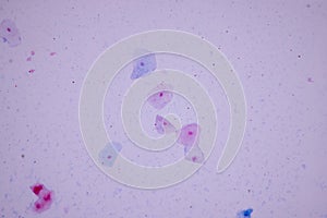 Histological sample Squamous epithelial cells under microscope.