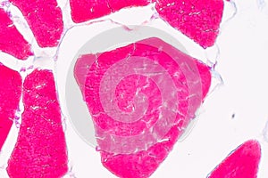 Histological sample Striated muscle Tissue under the microscope.