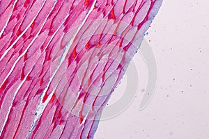 Histological sample Striated Skeletal muscle of mammal Tissue under the microscope.