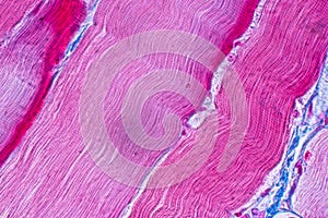 Histological sample Striated Skeletal muscle of mammal Tissue under the microscope.