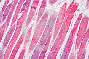 Histological sample Striated Skeletal muscle of mammal Tissue under the microscope.