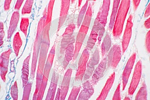 Histological sample Striated Skeletal muscle of mammal Tissue under the microscope.