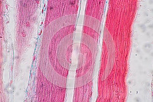 Histological sample Striated Skeletal muscle of mammal Tissue under the microscope.