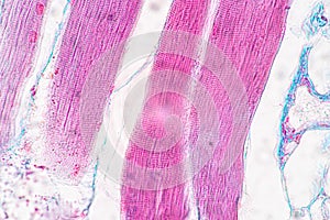 Histological sample Striated Skeletal muscle of mammal Tissue under the microscope.