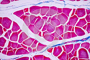 Histological sample Striated Skeletal muscle of mammal Tissue under the microscope.