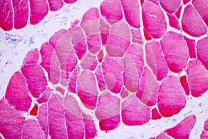 Histological sample Striated Skeletal muscle of mammal Tissue under the microscope.