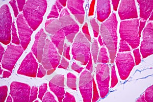 Histological sample Striated Skeletal muscle of mammal Tissue under the microscope.