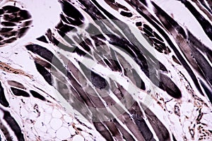 Histological sample Striated Skeletal muscle of mammal Tissue under the microscope.