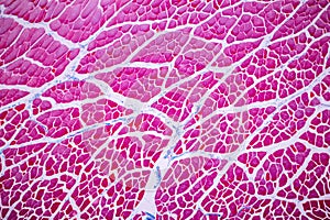 Histological sample Striated Skeletal muscle of mammal Tissue under the microscope. photo