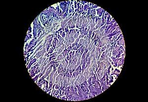 A histological slide of a tissue sample. Close microscopic view