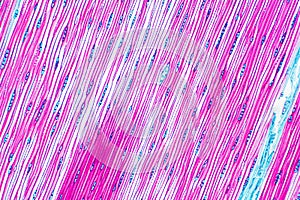 Histological structure of pine stem vascular bundle under microscope