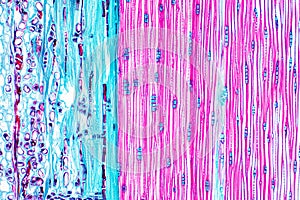 Histological structure of pine stem vascular bundle under microscope