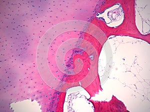 Histology Bone stained H&E