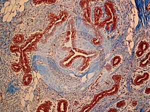 Histology of Breast Tissue