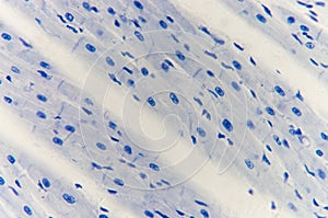 Histology of cardiac muscle