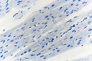 Histology of cardiac muscle