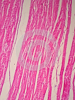 Histology of cardiac muscle