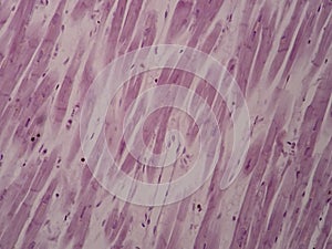 Histology of cardiac muscle