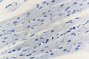 Histology of cardiac muscle photo