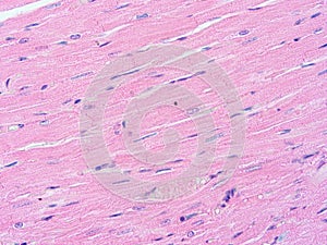 Histology of heart human tissue photo