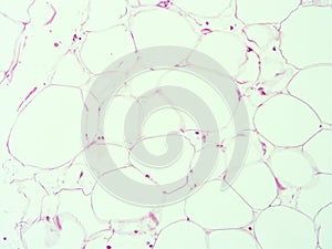 Histology of human adipose tissue photo