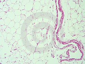 Histology of human adipose tissue