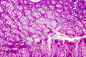 Histology of human appendix, micrograph showing Crypts of Lieberkuhn photo