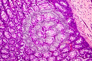 Histology of human appendix, micrograph showing Crypts of Lieberkuhn photo