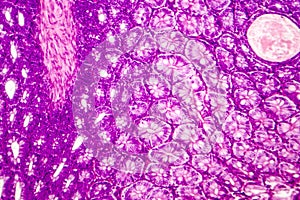 Histology of human appendix, micrograph showing Crypts of Lieberkuhn photo